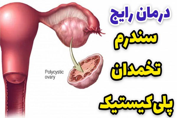 برای تقویت تخمدان تنبل چه بخوریم؟