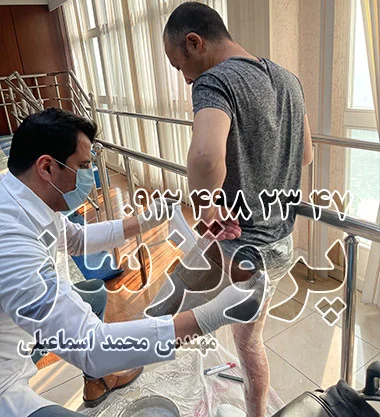نگاهی به دنیای پروتز پا بالای زانو