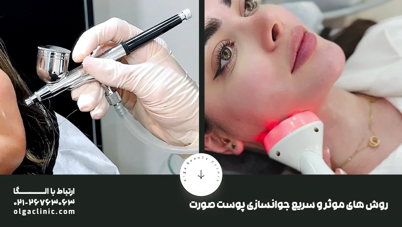 جوانسازی | پوست بهترین و سریعترین روش برای جوانسازی و سفتی پوست صورت