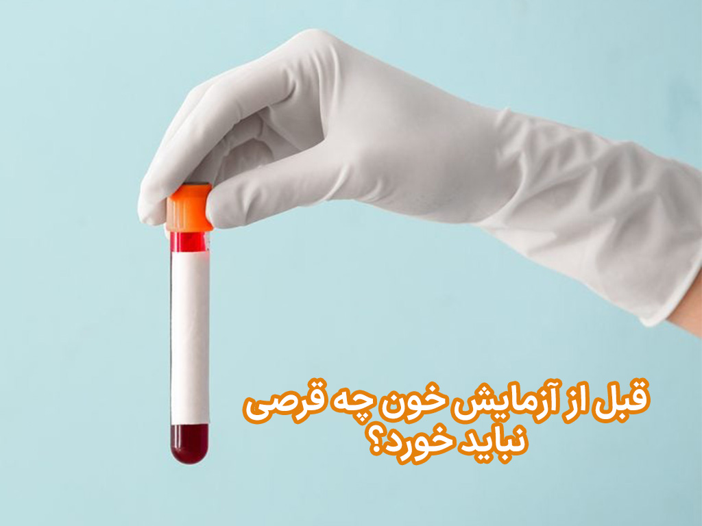 قبل از آزمایش خون چه قرصی نباید خورد؟