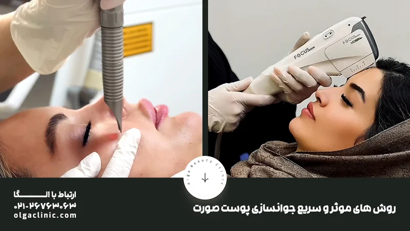 جوانسازی | پوست بهترین و سریعترین روش برای جوانسازی و سفتی پوست صورت